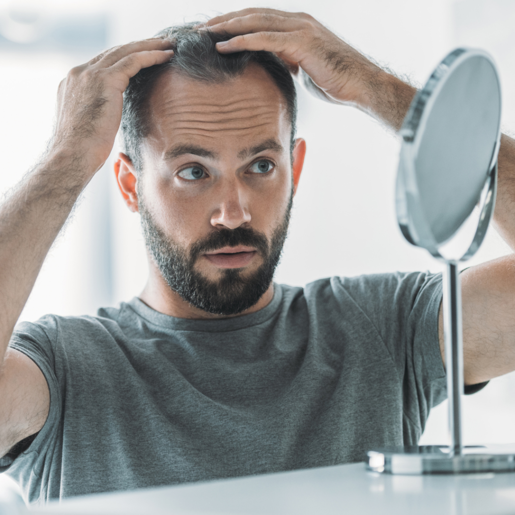Hombre mirándose al espejo preocupado porque se le cae el pelo